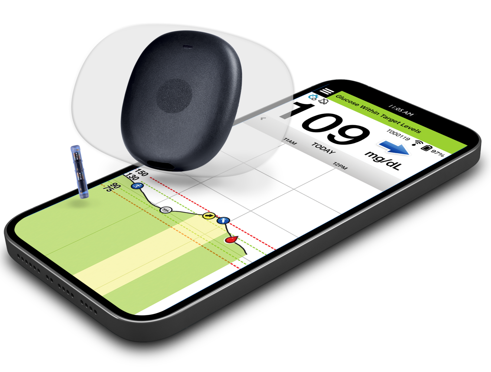 Eversense 365 – en glukosesensor under huden i ett år