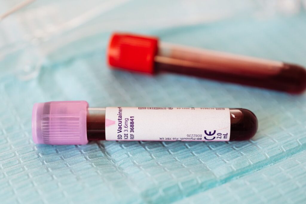 From above closeup of glass full of vein blood vials with different colors lids placed on medical diaper
